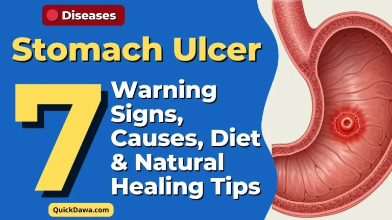 Stomach Ulcer